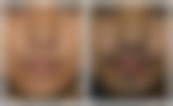 九、青岛伊美尔加禾植发连锁机构口碑与评价