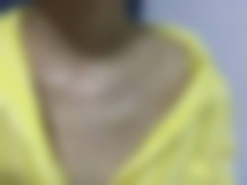 十四、苏州睿恩医疗美容门诊部患者常见问答