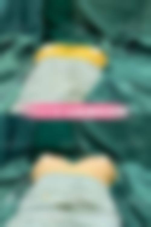 隆胸的医学背景与选择指征