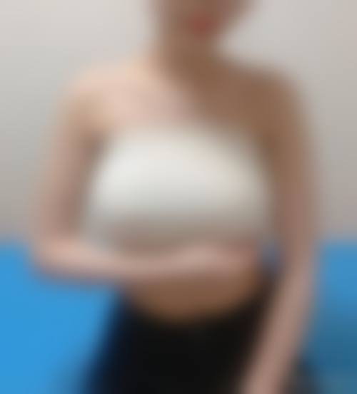 隆胸的危害都有哪些？假体隆胸包膜挛缩、自体脂肪隆胸脂肪液化等后遗症大揭秘！ 