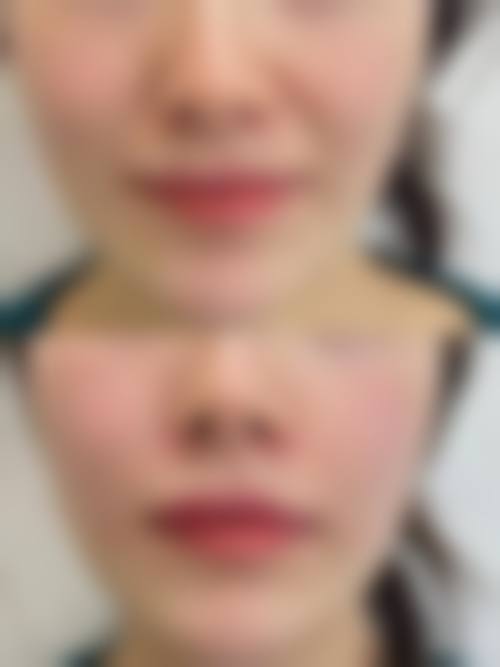 五、广州颐美医疗美容诊所重点特色诊疗项目