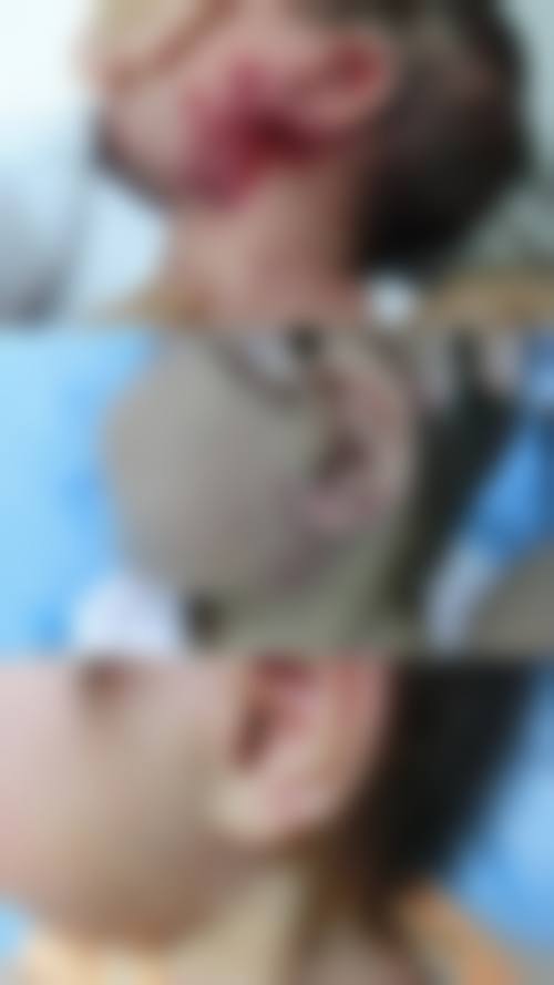 福州瑞丽医疗美容门诊部温馨提示——为了节省您的时间,看诊前请预约哦!