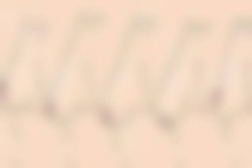 揭秘:奥美定隆鼻后有什么副作用