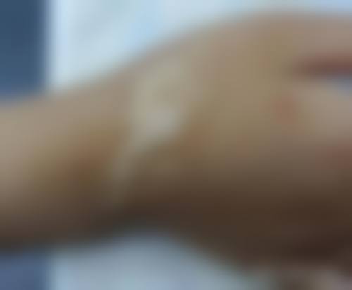 患者常见问题解答(精选)