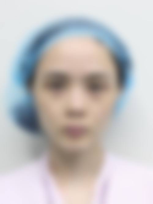 注射隆鼻有什么缺点？2026医生警告：血管栓塞/皮肤坏死/效果短暂，3大风险别忽视！