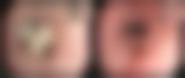 三、周书香医生擅长项目介绍