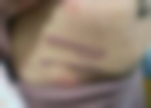 七、大连艾美悦医疗美容门诊部特色项目技术怎么样