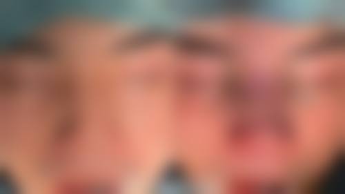 耳软骨隆鼻后如何确保手术成效？