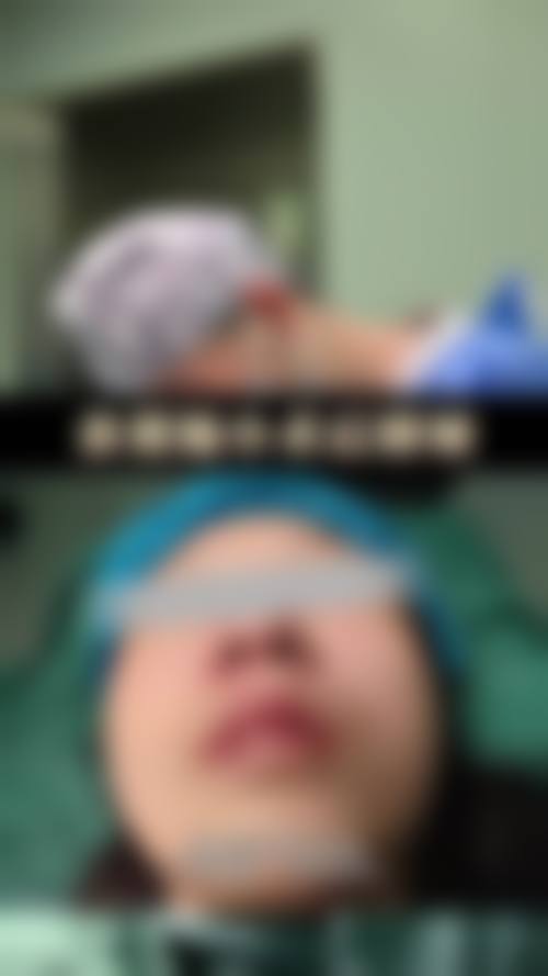 耳软骨隆鼻手术后需要注意什么？这份1-7天恢复指南和饮食禁忌请收好