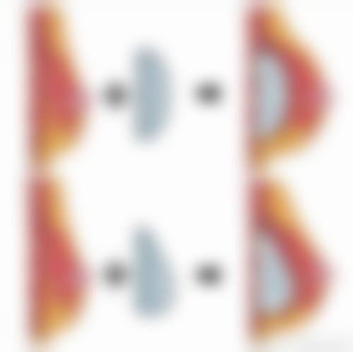 二、假体隆胸位置过高通常在什么阶段被纳入医疗选择范围？