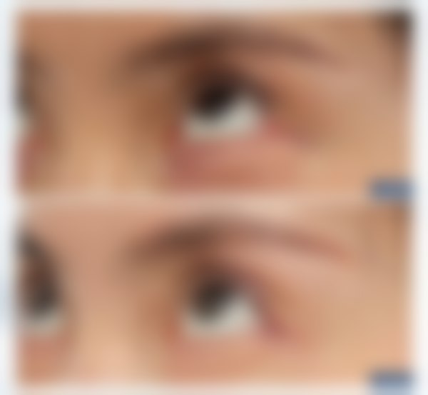 二、尹轩羽擅长项目及优势