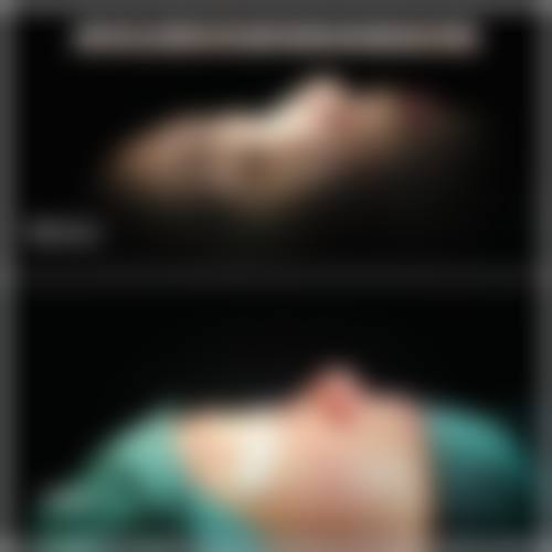 南通李辉鼻综合价格贵吗？项目费用透明公开