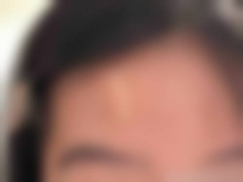 东莞凤岗天天美整形医院温馨提示——为了节省您的时间，看诊前请预约哦！