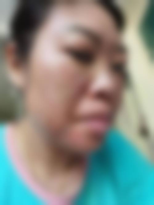 四、合肥中山医院皮肤美容科医生团队构成表/医生名单