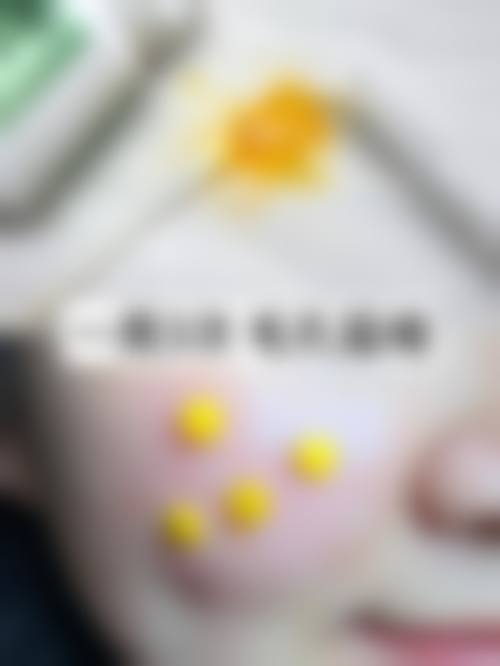 三、合肥中山医院皮肤美容科开展项目