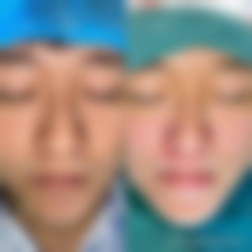 总结：选择李辉院长，开启你的变得更美之旅