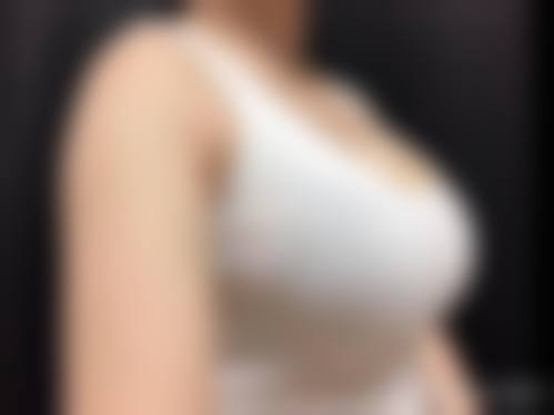 南通英莎就医体验好不好？求美者真实反馈+服务细节曝光