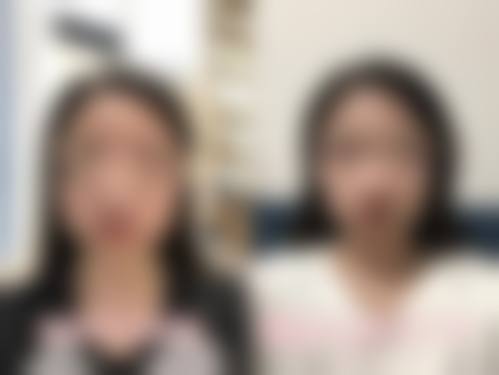 影响瘦脸针成效持久度的因素有哪些