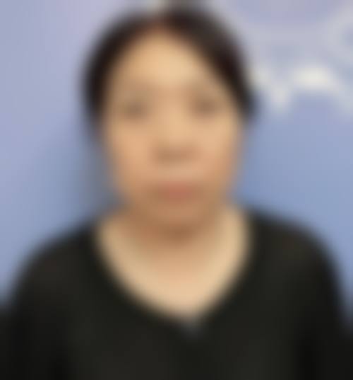 熬夜眼袋大怎么办？去眼袋的小窍门：5个简单方法快速消除，告别眼肿超有效！