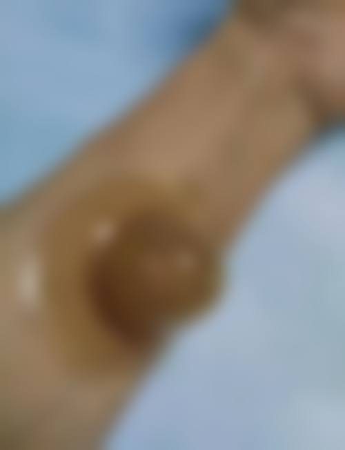 五、梅州曙光医疗美容整形医院价格表区间/收费标准说明