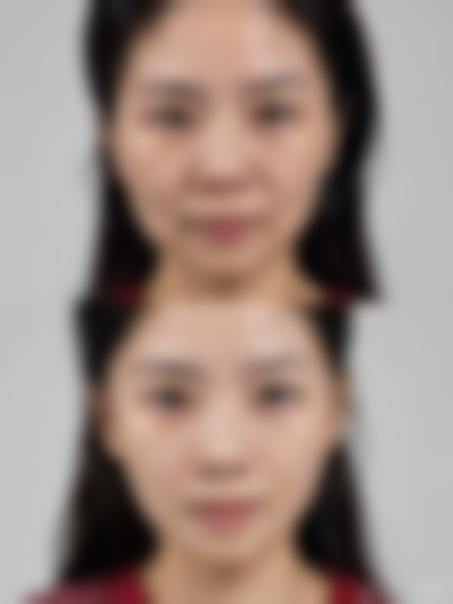 二、李明英医生擅长项目