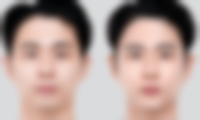 青岛瑧妍美价格表公开吗？热门项目收费一览