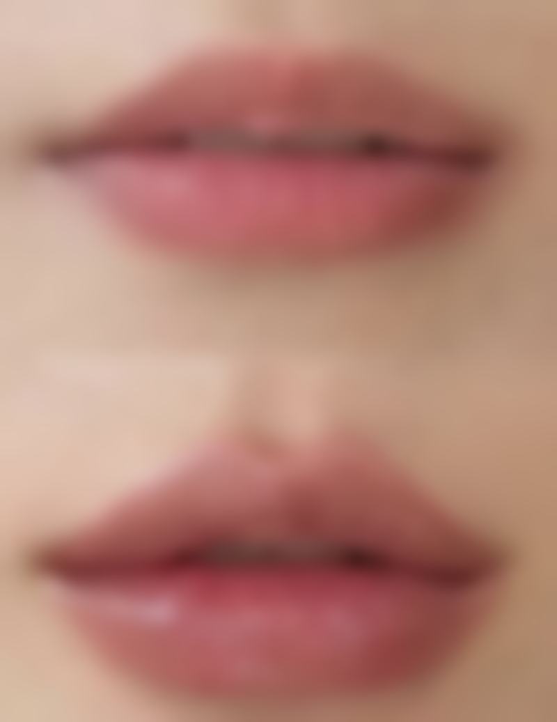 八、患者常见问题解答（精选 ）