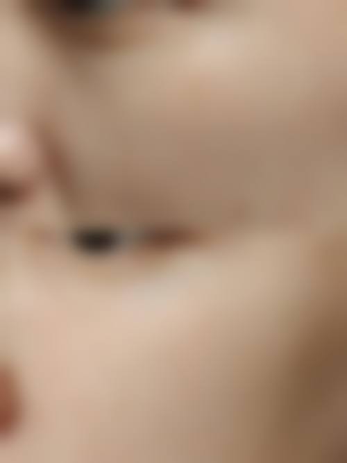 如何选择合适的医院和医生消除男生眼袋?