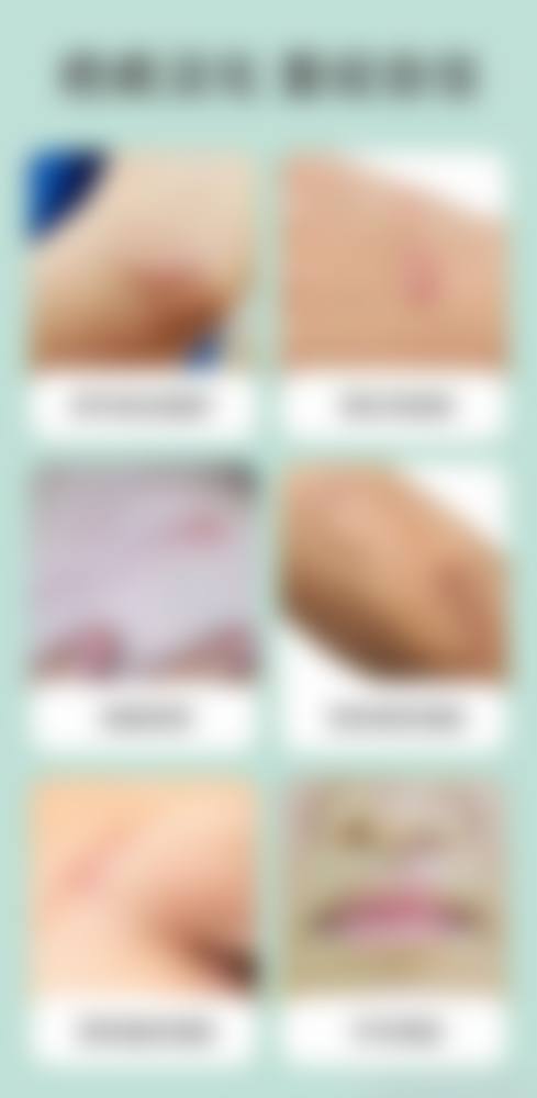 刘志医生：独特技术，高修复率