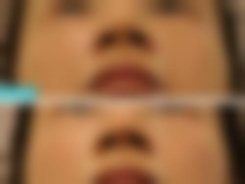 二、北京澳玛星光医疗美容医院怎么样