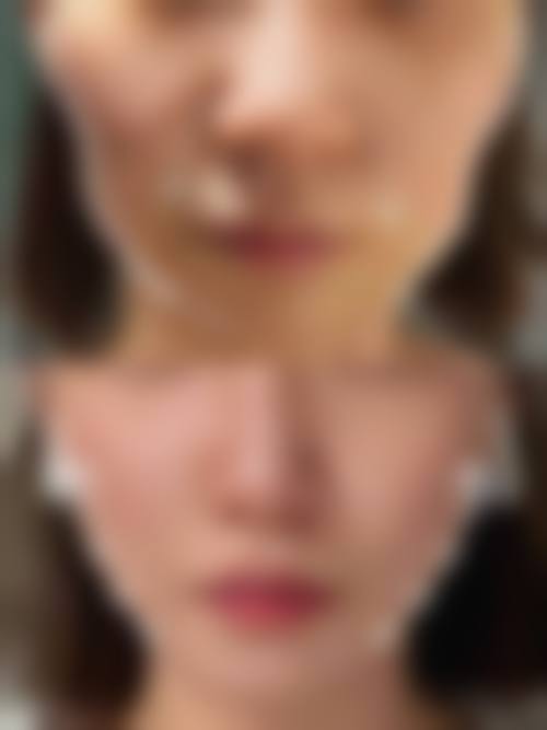 七、北京澳玛星光医疗美容医院特色项目技术怎么样