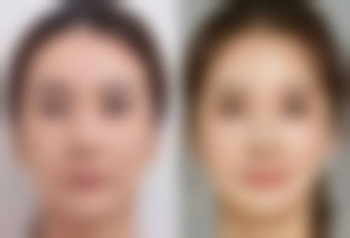 疤痕妊娠怎么做堕胎检查