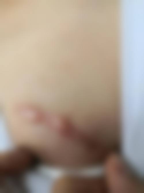 小孩脸上磕伤的疤痕怎么办