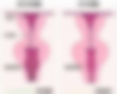 眼袋白色脂肪粒怎么办？40℃热敷、500-2000元激光，搞定眼周粒状白脂肪粒