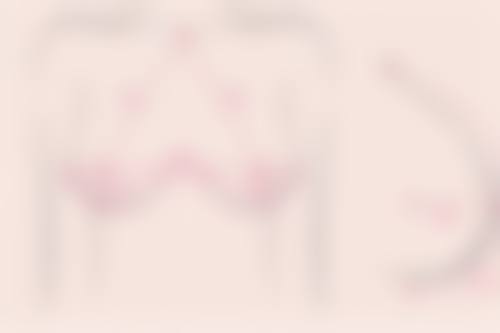 七、郑州精蝶整形医院收费价格表