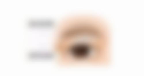 药物治疗：小药丸大作用，能消除脂肪粒吗？