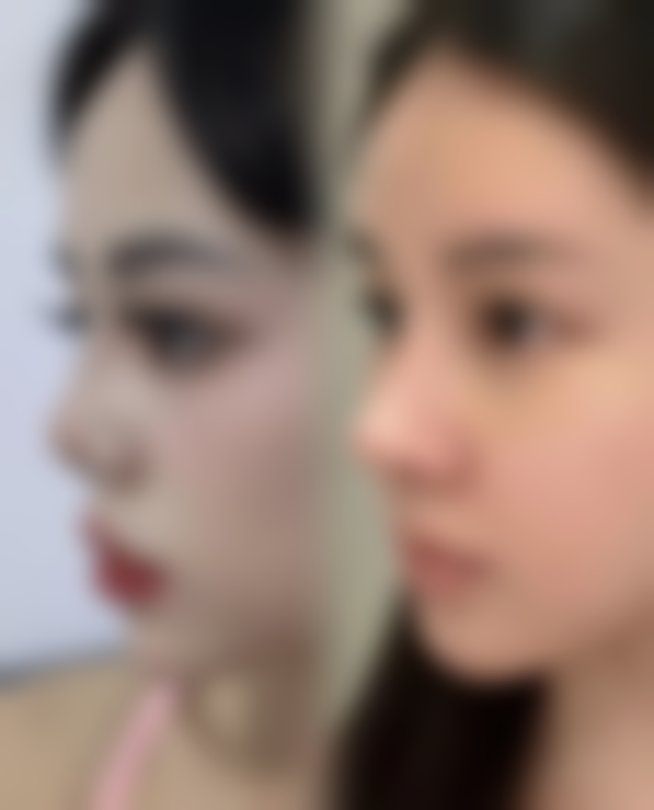 二、郭昱医生擅长项目