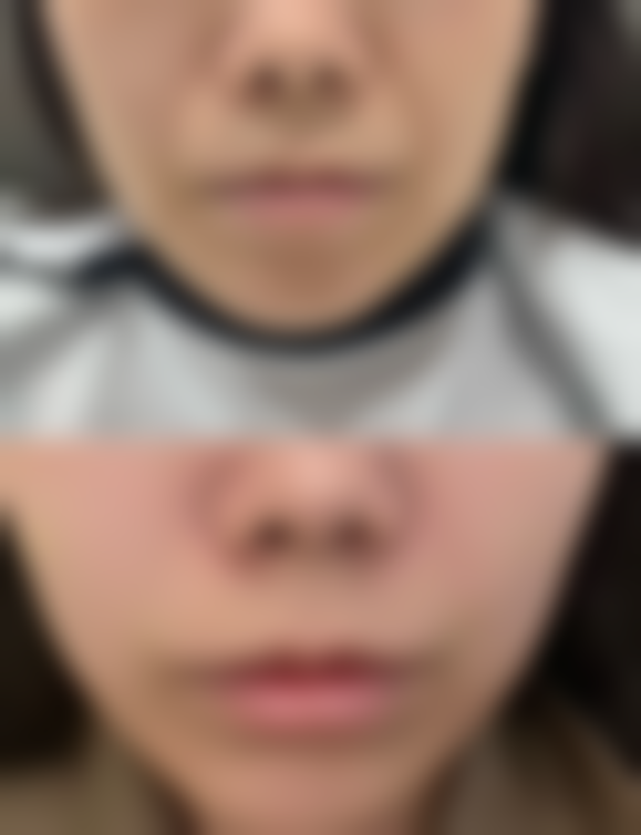 八、郑州精蝶整形医院是医疗定点吗