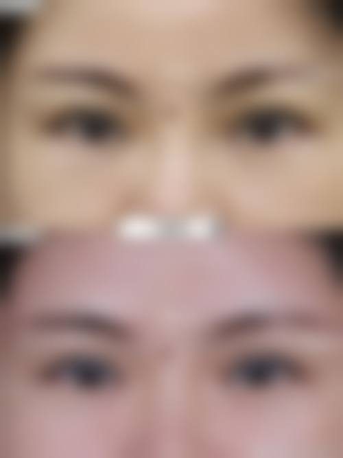 九、韩国I WANT整形外科收费价格表（2026年）