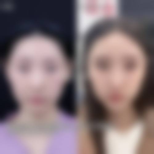 八、韩国I WANT整形外科特色项目技术怎么样