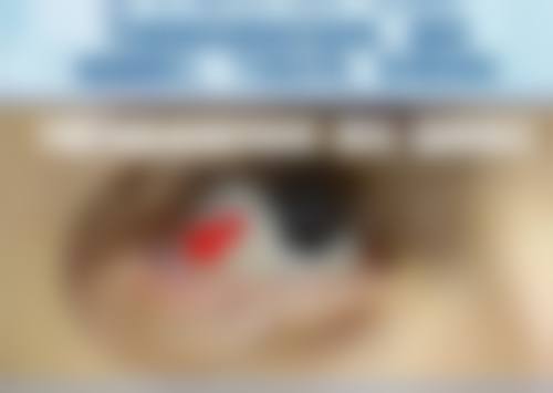 做了埋线双眼皮开眼角的常见认知偏差与误解