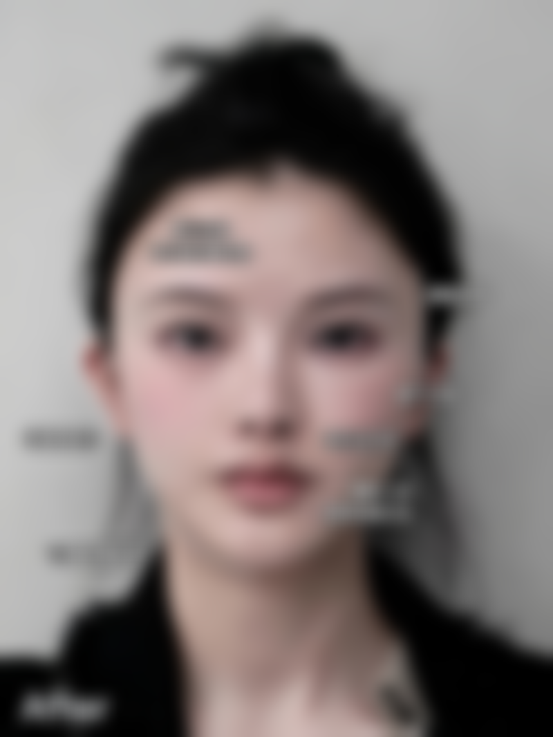 三、李国玲1医生做手术价格：