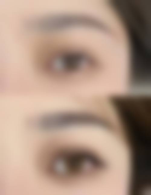 三、叶锦医生植发技术水平高吗？