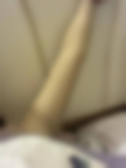 腿部抽脂怎么选择医院医生?