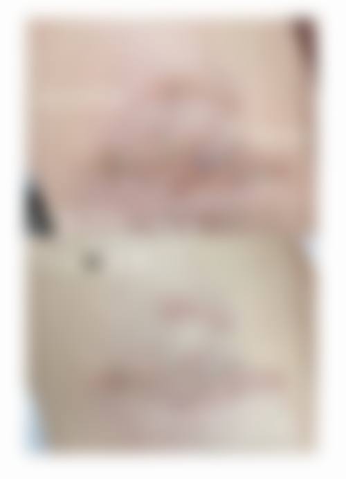 8、患者常见问题解答(精选 )