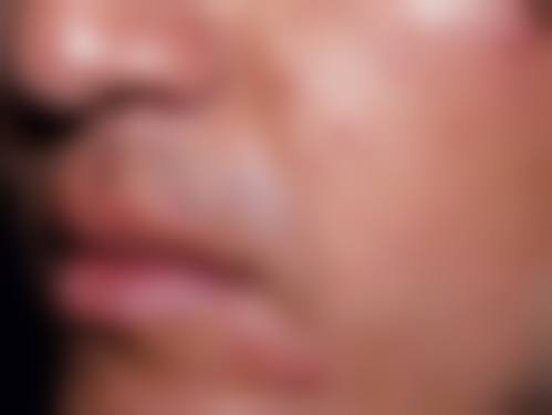 浙江省医美小切口筋膜提升的具有影响力骨干医生有哪些？