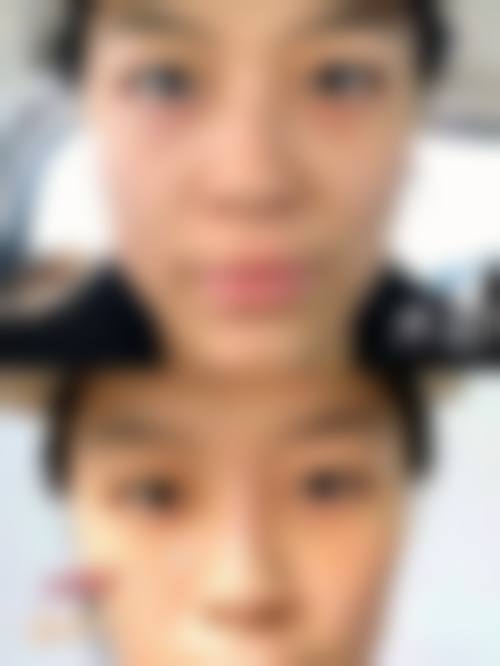 选择喂奶可以做双眼皮吗相关医院与医生时，应重点看哪些维度？