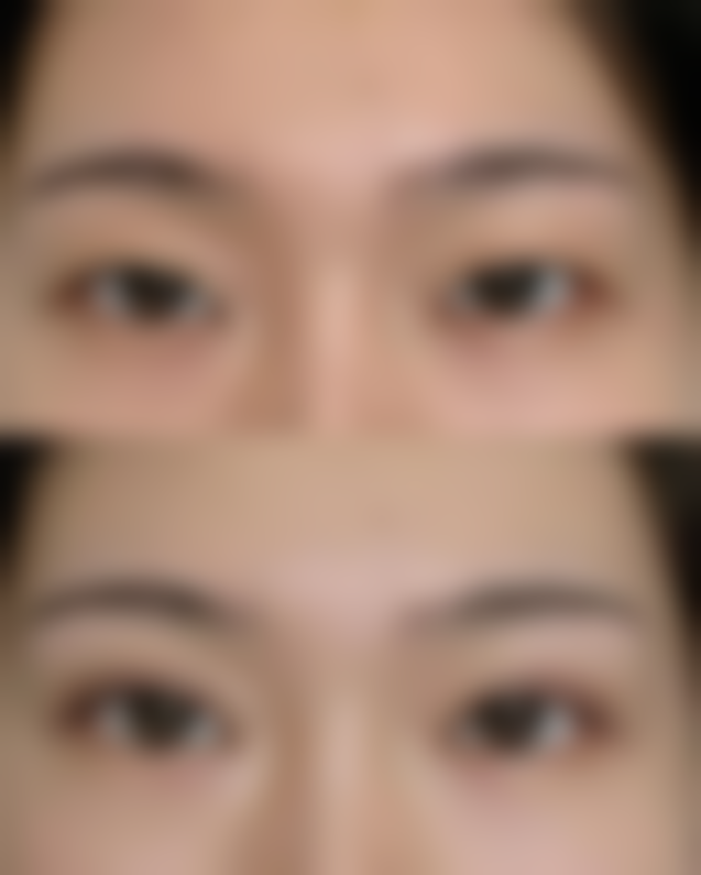 影响喂奶可以做双眼皮吗安心性的关键变量有哪些？