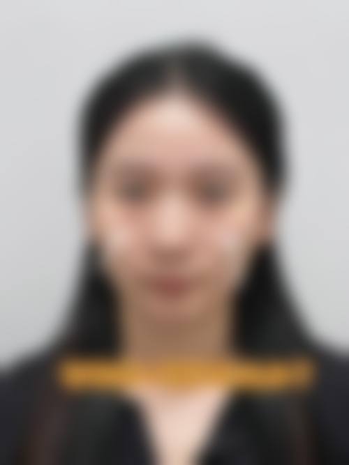 七、深圳星面孔柯思整形医院常见问题解答