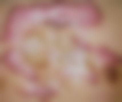 五、日本日比谷美容外科医院价格表区间/收费标准说明